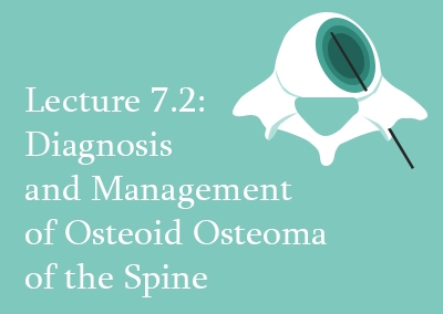 7.2 Diagnosis and management of Osteoid Osteoma of the spine