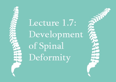 1.7 Development of Spinal Deformity