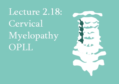 2.18 Cervical Myelopathy: Ossified Posterior Longitudinal Ligament (OPLL)