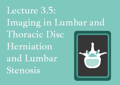 3.5 Imaging in Thoracolumbar Disc Herniation
