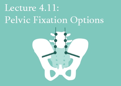 4.11 Pelvic Fixation Options