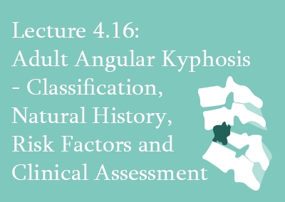 4.16 Adult Angular Kyphosis – Classification, Natural History, Risk Factors and Clinical Assessment