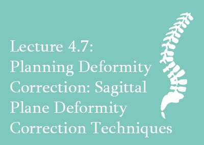 4.7 Planning deformity correction: Sagittal Plane Deformity Correction Techniques