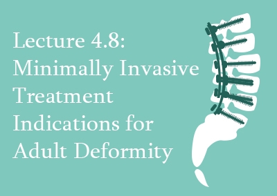 4.8 Minimally Invasive Treatment Indications for Adult Deformity