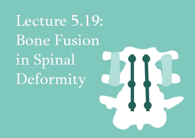 5.19 Bone Fusion in Spinal Deformity
