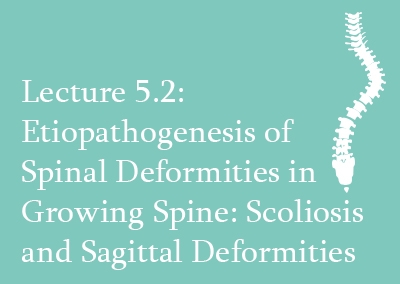 5.2 Etiopathogenesis of Spinal Deformities in Growing Spine: Scoliosis and Sagittal Deformities
