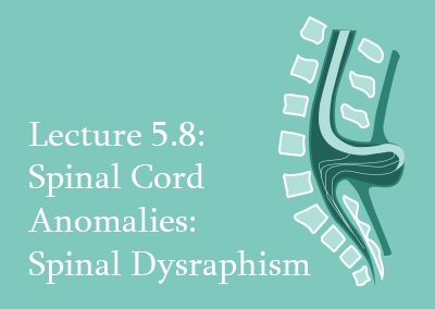 5.8 Spinal Cord Anomalies: Spinal Dysraphism
