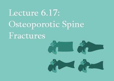 6.17 Osteoporotic Spine Fractures