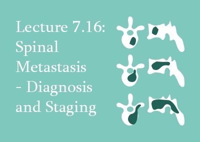 7.16 Spinal Metastasis – Diagnosis and Staging