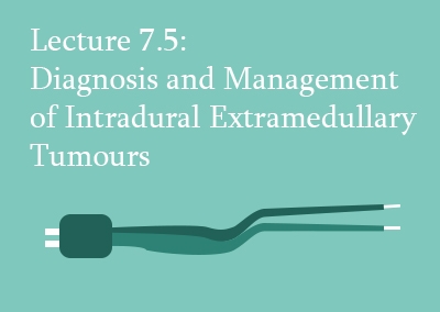 7.5 Diagnosis and Management of Intradural Extramedullary Tumours
