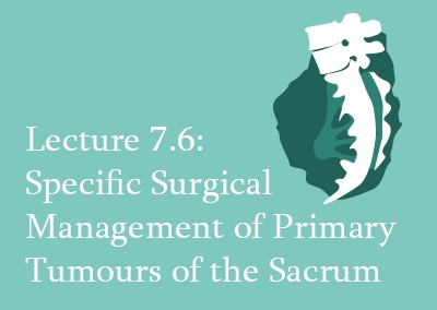 7.6 Specific Surgical Management of Primary Tumours of the Sacrum