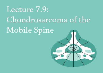 7.9 Chondrosarcoma of the Mobile Spine
