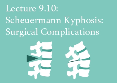 9.10 Scheuermann Kyphosis: Surgical Complications