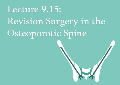 9.15 Revision Surgery in the Osteoporotic Spine
