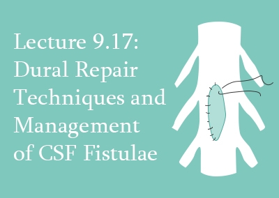 9.17 Dural Repair Techniques and Management of CSF Fistulae