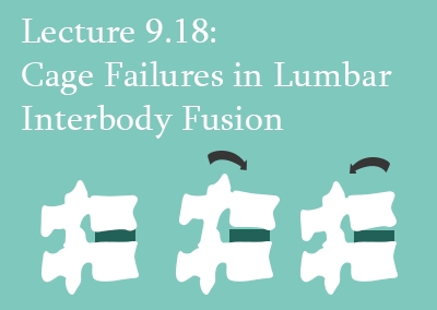 9.18 Cage Failures in Lumbar Interbody Fusion