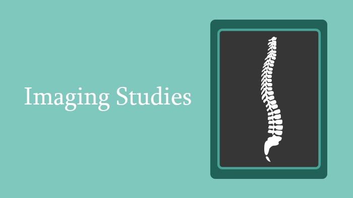 Imaging Studies of the Spine - Lecture Thumbnail