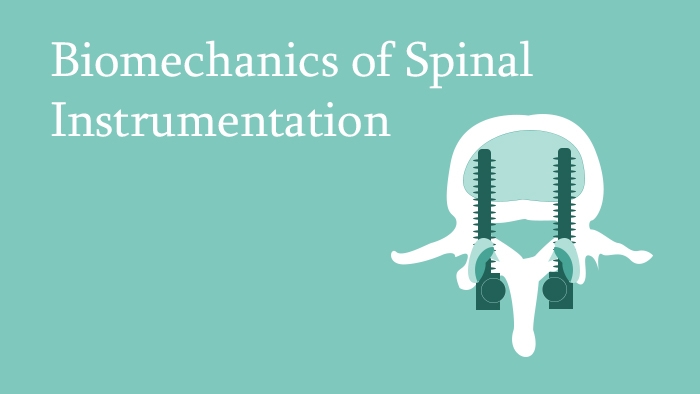 Biomechanics of Spinal Instrumentation - Spine Surgery Lecture - Thumbnail