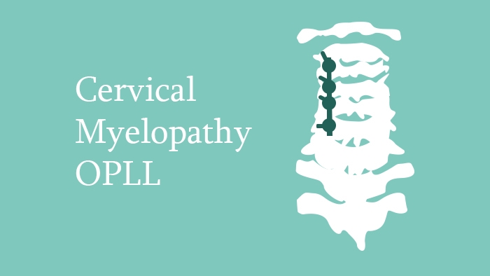 Cervical Myelopathy: Ossified Posterior Longitudinal Liagment (OPLL) Lecture Thumbnail