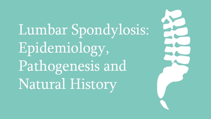 Lumbar Spondylosis: Epidemiology, Pathogenesis and Natural History Lecture Thumbnail