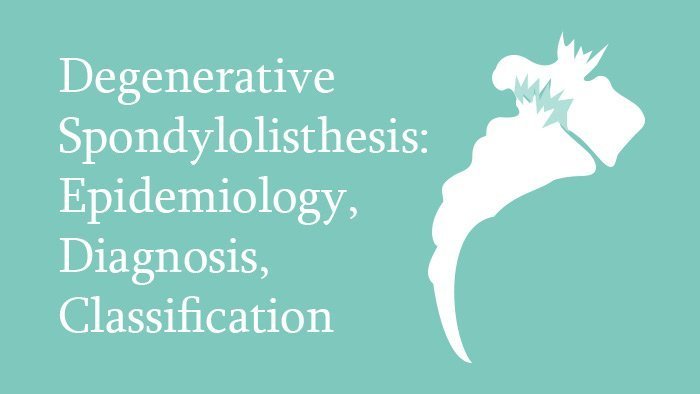 Degenerative Spondylolisthesis: epidemiology, diagnosis, classification lecture thumbnail
