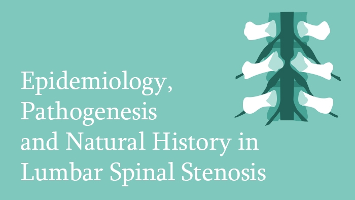 Epidemiology, Pathogenesis and Natural History in Lumbar Spinal Stenosis Lecture Thumbnail