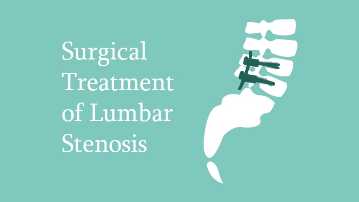 Surgical Treatment of Lumbar Stenosis Lecture Thumbnail