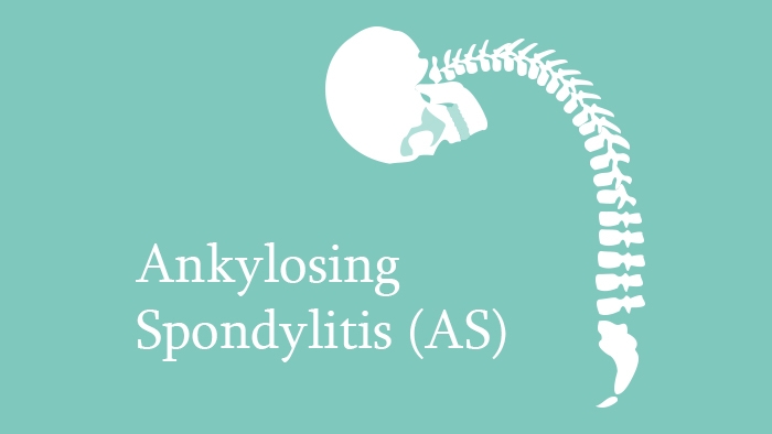 Ankylosing Spondylitis (AS) Lecture Thumbnail