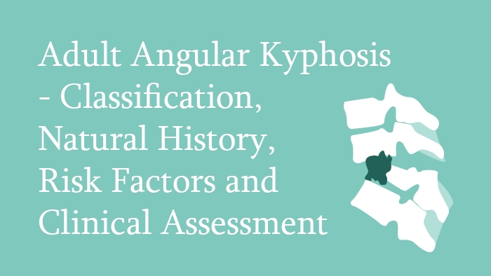 Adult Angular Kyphosis – Classification, Natural History, Risk Factors and Clinical Assessment Lecture Thumbnail