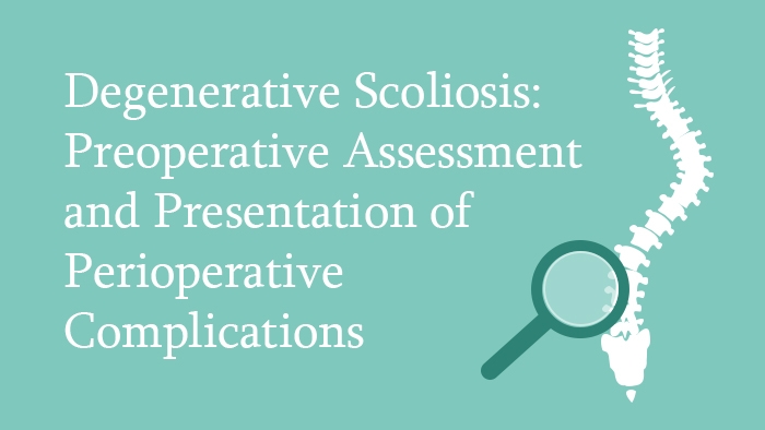 Degenerative Scoliosis preoperative assessment - Spine Surgery lecture - thumbnail