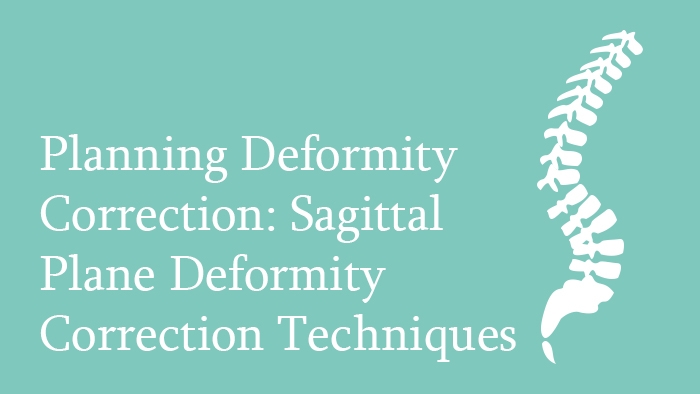 Planning Deformity Correction Lecture Thumbnail