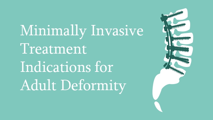 Minimally invasive treatment indications for adult deformity of the spine lecture thumbnail