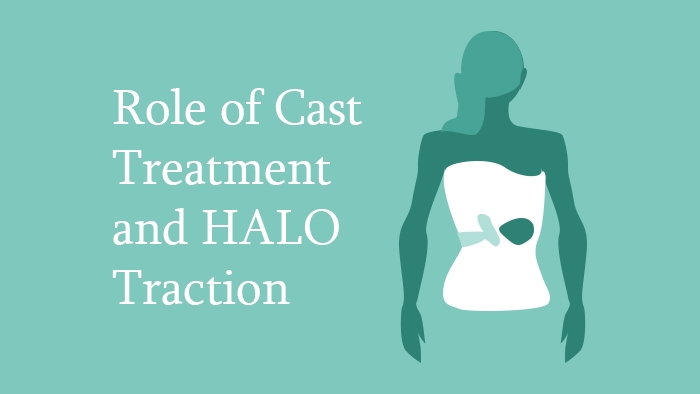 Role of Cast Treatment and HALO Traction Lecture Thumbnail