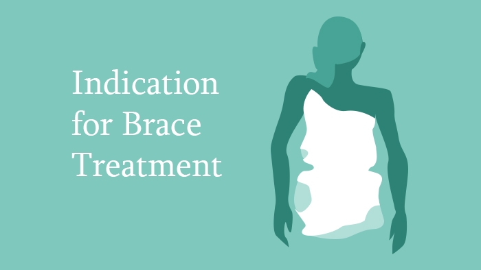 Indication for Brace Treatment Lecture Thumbnail