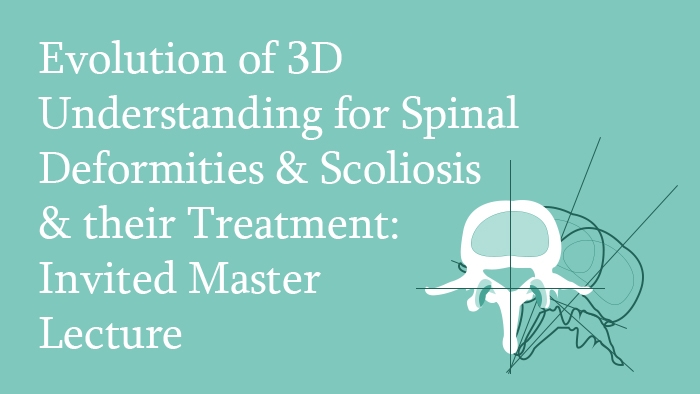 Invited Master Lecture: Evolution of the 3D Understanding for Spinal Deformities, Scoliosis and their Treatment Lecture Thumbnail