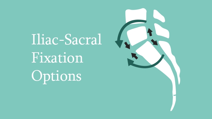 Iliac-Sacral Fixation Options Lecture Thumbnail