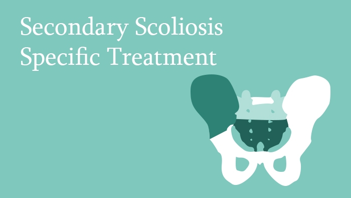 Secondary Scoliosis Specific Treatment Lecture Thumbnail