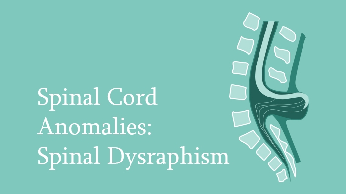 Spinal Cord Anomalies: Spinal Dysraphism Lecture Thumbnail