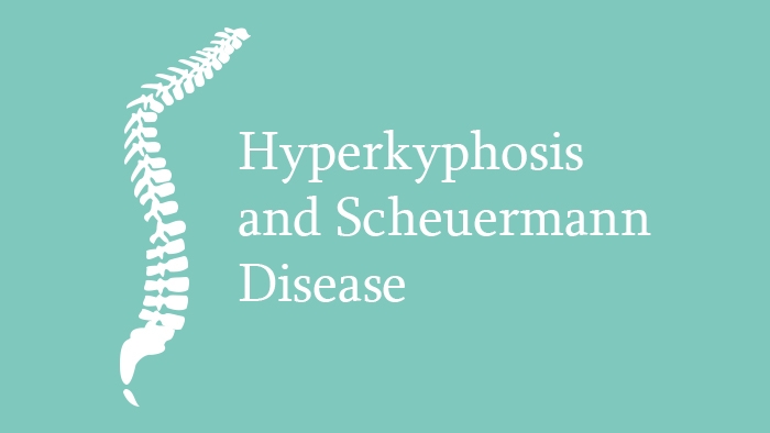 Hyperkyphosis lecture thumbnail