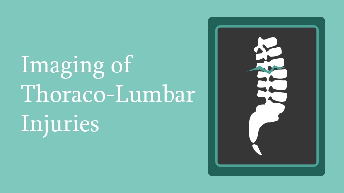 Imaging of Thoraco-lumbar spine injuries lecture thumbnail