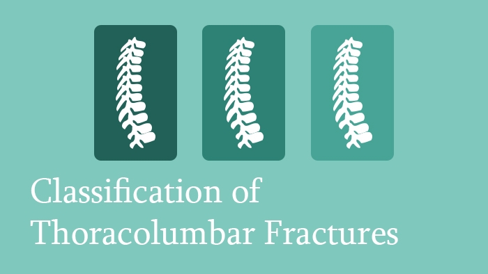 Classification of Thoracolumbar Spine Fractures - Spine Surgery Lecture - Thumbnail