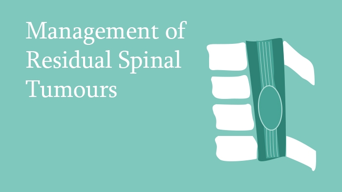 Management of Residual Spinal Tumours Lecture Thumbnail