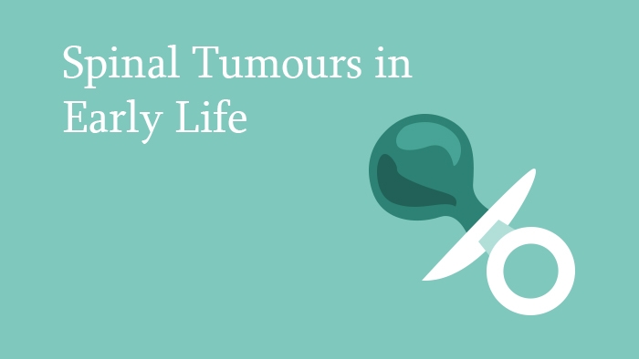 Spinal Tumours in Early Life Lecture Thumbnail