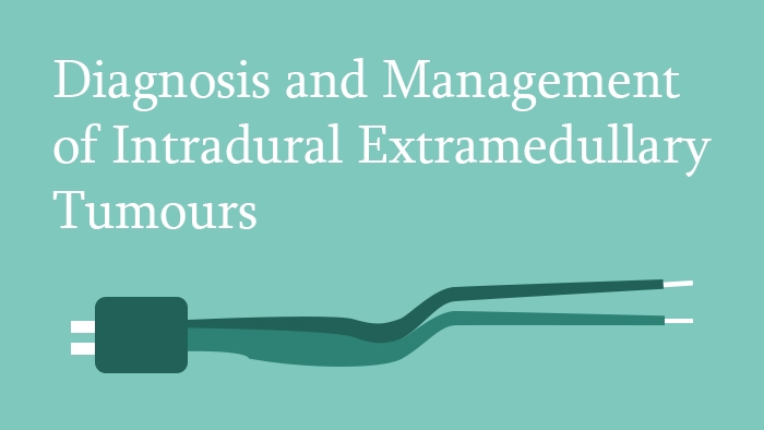 Diagnosis and Management of Intradural Extramedullary Tumours Lecture Thumbnail