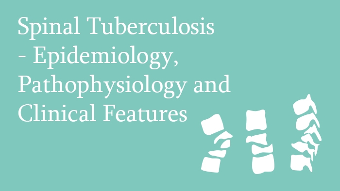 Spinal Tuberculosis – Epidemiology, Pathophysiology and Clinical Features Lecture Thumbnail