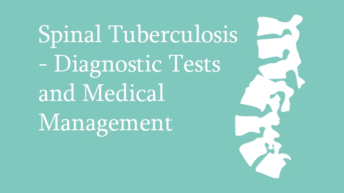 Spinal Tuberculosis diagnostic tests and medical management lecture thumbnail
