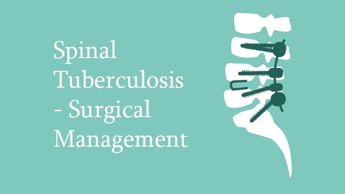 Spinal Tuberculosis Surgical Management Lecture Thumbnail