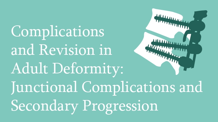 Complications and Revision in Adult Spinal Deformity: Junctional Complications and Secondary Progression Lecture Thumbnail