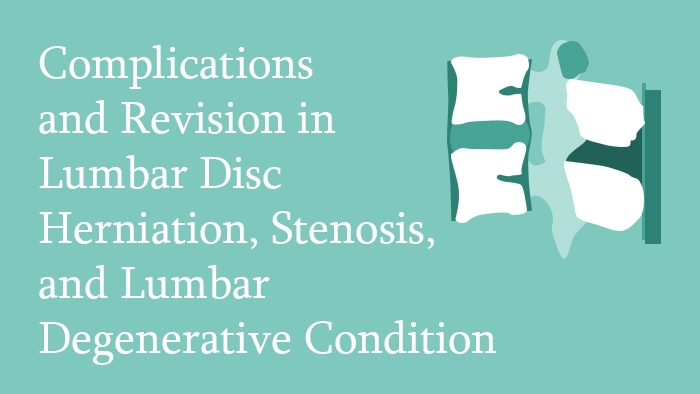 Complications and Revision in Lumbar Disc Herniation, Stenosis, and Lumbar Degenerative Condition Lecture Thumbnail