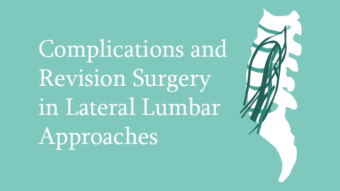 Complications and Revision Surgery in Lateral Lumbar Approaches Lecture Thumbnail